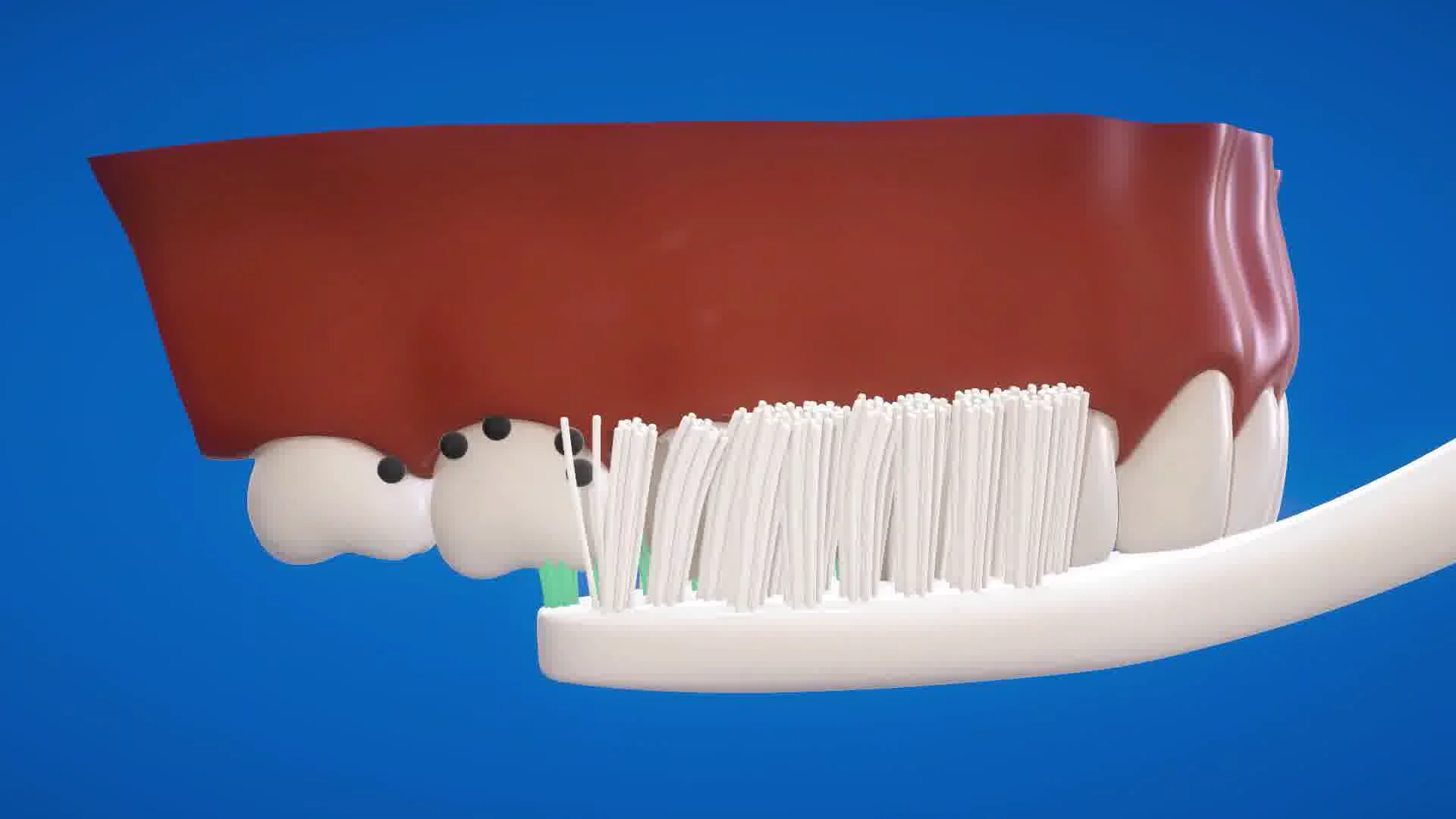 Groove Toothbrush Upper Arch Inverted Cleaning